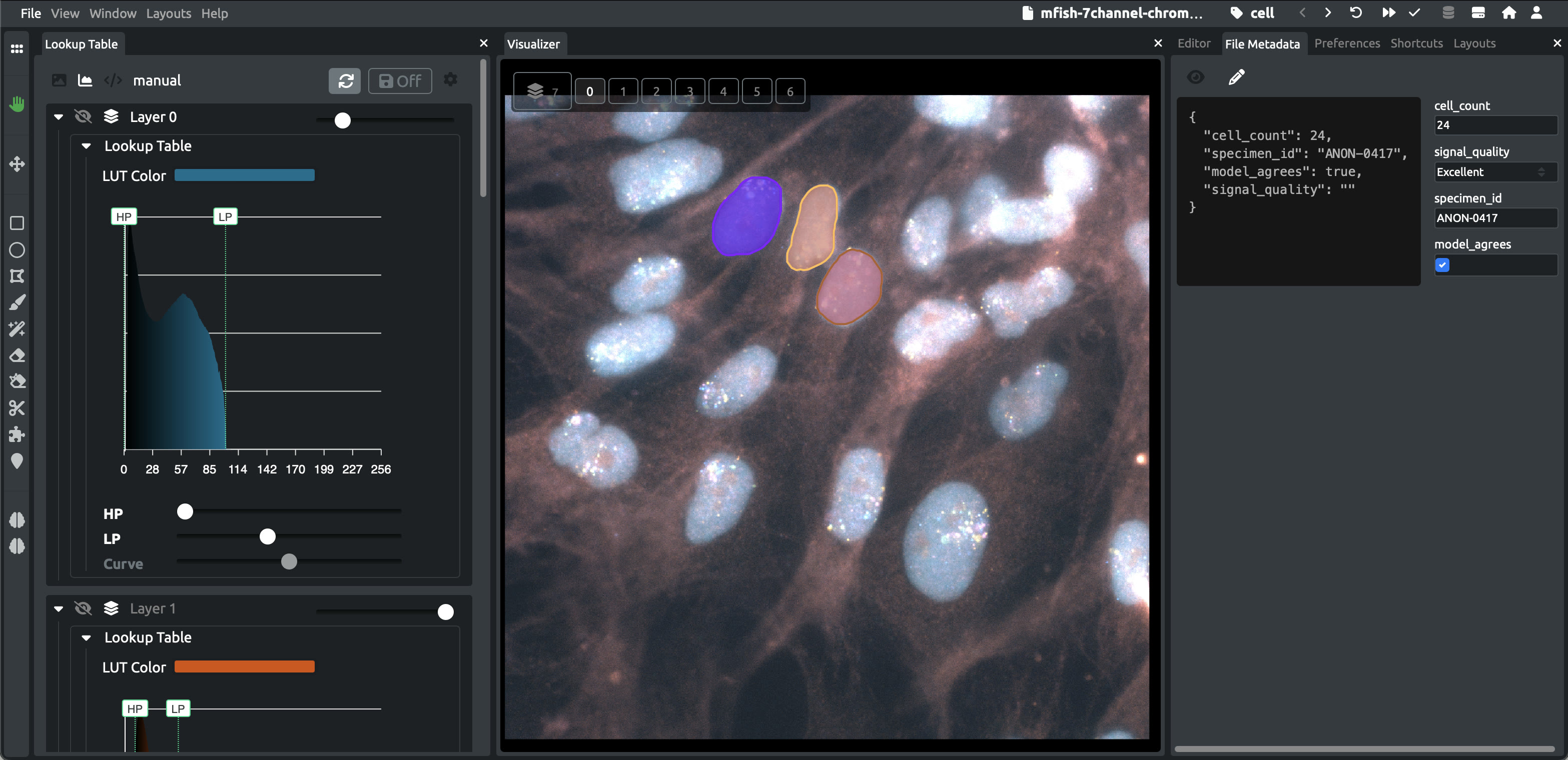 A seven-channel fluorescence image under review in DataTorch: three cells outlined as annotations, the lookup-table panel open on the left with a per-channel histogram and highpass/lowpass controls, and a file-metadata scoring form on the right showing cell count, signal quality, an anonymised specimen ID, and an "agrees with model" checkbox that has been ticked.
